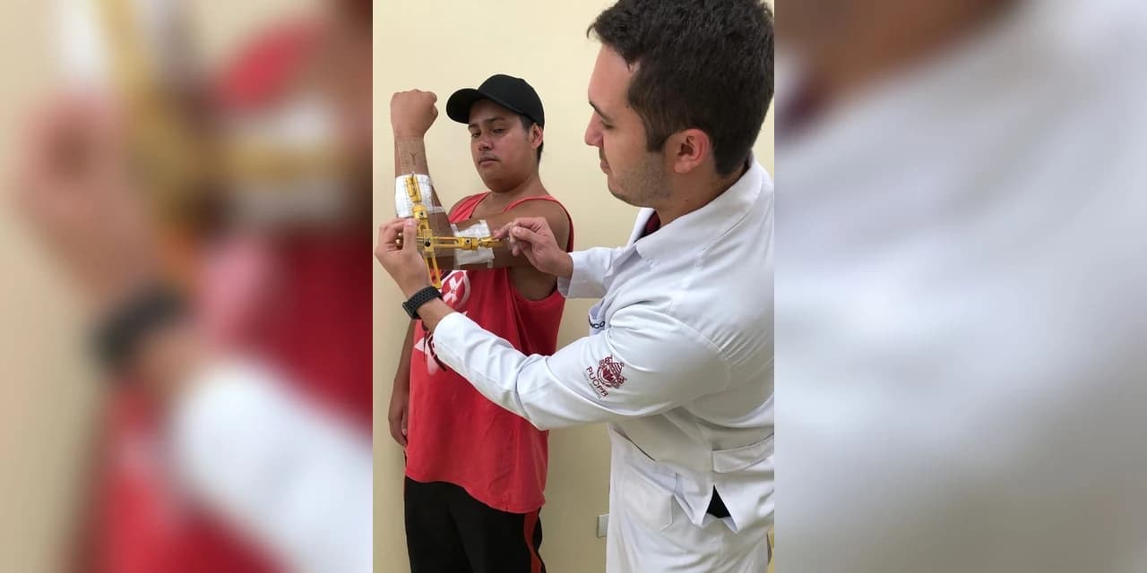Cirurgia rara de cotovelo devolve movimento a paciente