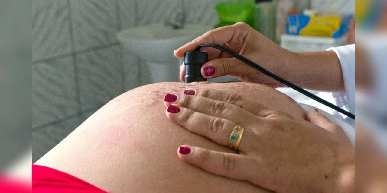 Lei que reduz idade mínima para laqueadura é sancionada