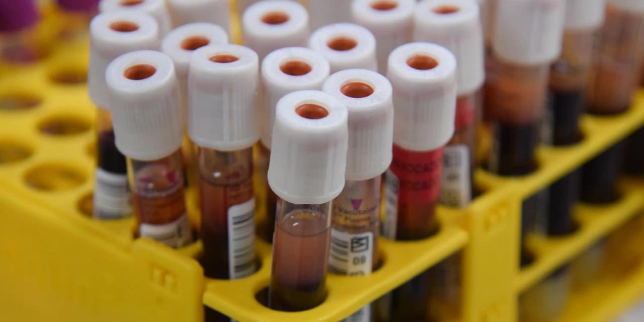 Governo e Fundação Pró-Renal garantem 300 exames renais à população negra