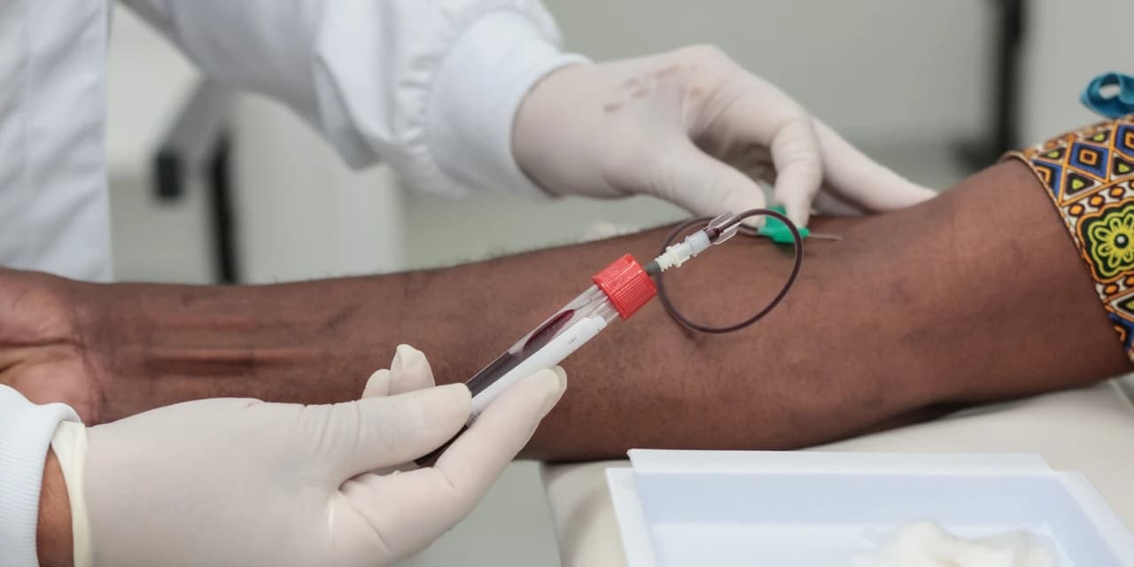 Governo e Fundação Pró-Renal iniciam ciclo de exames renais para pessoas negras