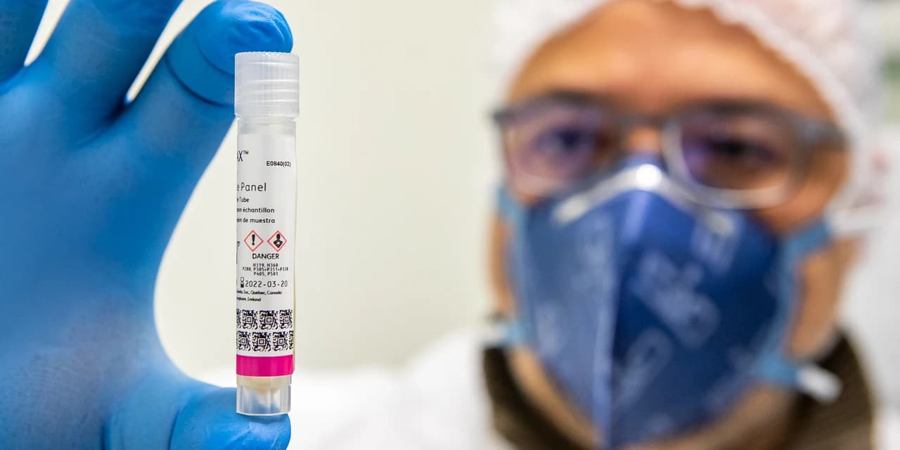 Em seis meses, Lacen processa 13.298 amostras de vírus respiratórios