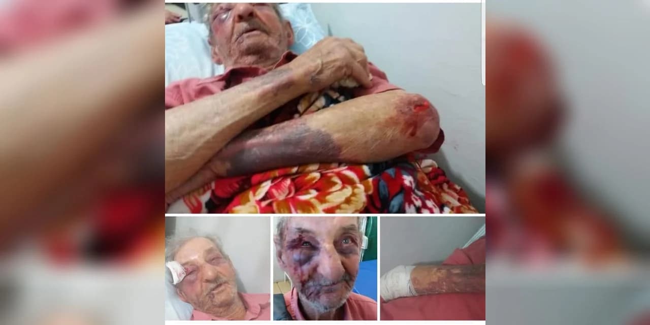 Idoso de 91 anos é agredido por bandido em Antônio Olinto