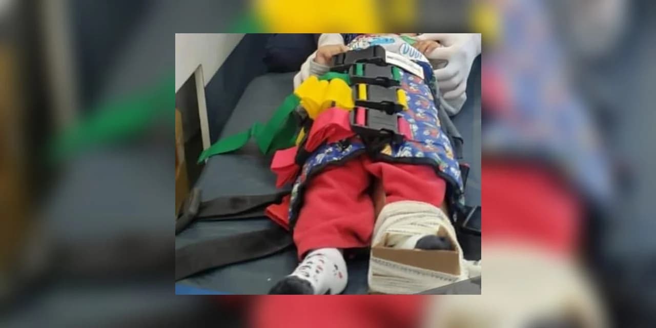 Covarde. Pai agride e quebra fêmur de bebê de 9 meses