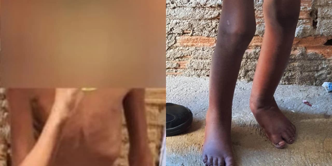 Menino mantido em barril diz que pai o lavava com água sanitária e que viu Revéillon por um buraco