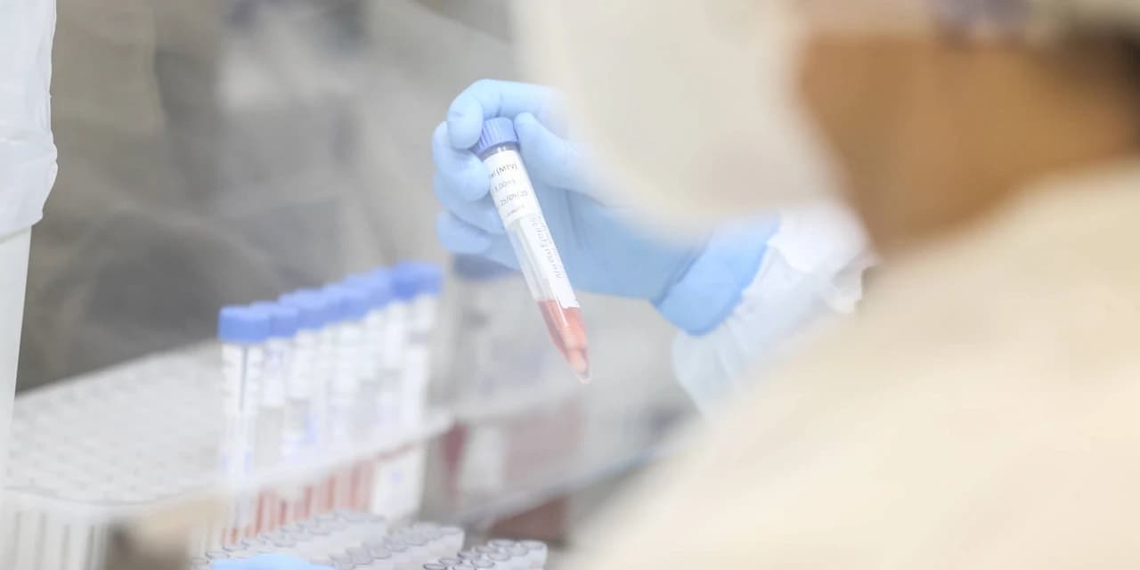 Saúde divulga mais 2.506 casos e 53 óbitos pela Covid-19 no Paraná