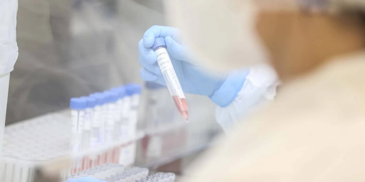 Paraná confirma 2.659 novos casos Covid-19 e 22 óbitos pela doença