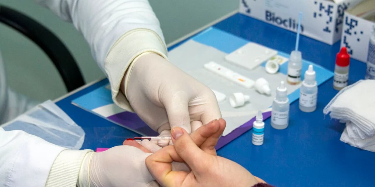 Câmpus Irati da Unicentro realiza testes rápidos para detecção de hepatites B e C