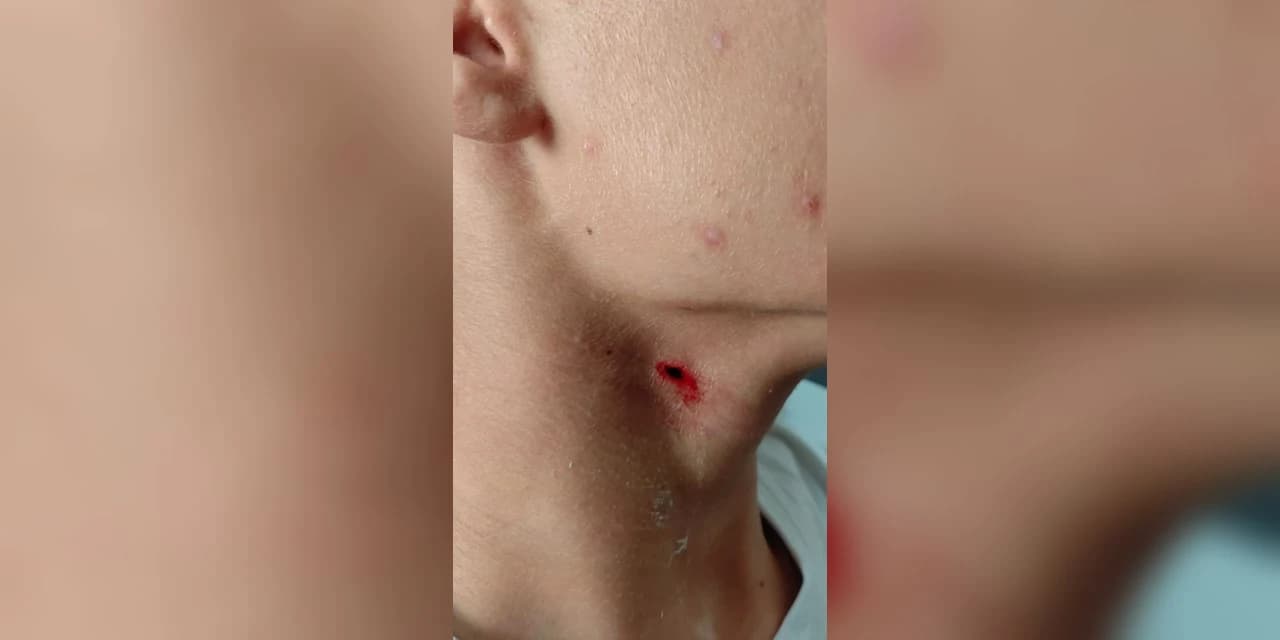 Polícia civil de Ponta Grossa apreende adolescente por tentativa de homicídio após golpe com caneta no pescoço em escola